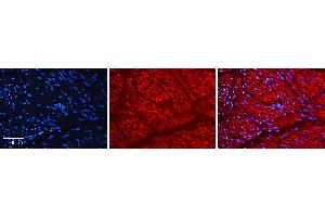 Rabbit Anti-AHR Antibody   Formalin Fixed Paraffin Embedded Tissue: Human Urinary Bladder Tissue Observed Staining: Cytoplasm Primary Antibody Concentration: 1:100 Other Working Concentrations: N/A Secondary Antibody: Donkey anti-Rabbit-Cy3 Secondary Antibody Concentration: 1:200 Magnification: 20X Exposure Time: 0.