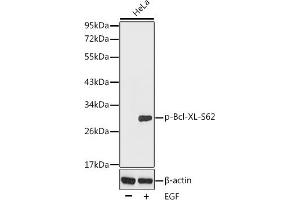 Western blot analysis of extracts from HeLa cells using Phospho-Bcl-XL-S62 antibody (ABIN3020105, ABIN3020106 and ABIN3020107).