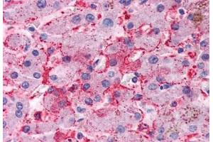 Human Liver (formalin-fixed, paraffin-embedded) stained with DC2 antibody ABIN351430 at 10 ug/ml followed by biotinylated goat anti-rabbit IgG secondary antibody ABIN481713, alkaline phosphatase-streptavidin and chromogen.