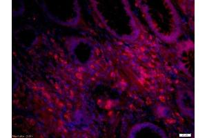 paraformaldehyde-fixed, paraffin embedded human colon carcinoma tissue, Antigen retrieval by boiling in sodium citrate buffer(pH6) for 15min, Block endogenous peroxidase by 3% hydrogen peroxide for 30 minutes, Blocking buffer (normal goat serum) at 37°C for 20min, Antibody incubation with Rabbit Anti-IL12 Polyclonal Antibody, Unconjugated  at 1:500 overnight at 4°C, followed by a conjugated secondary and DAPI staining