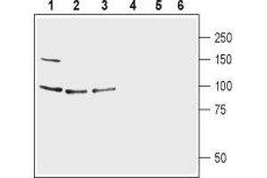 Western blot analysis of human CCF-STTG1 astrocytoma cell lysate (lanes 1 and 4), mouse brain lysate (lanes 2 and 5) and rat brain lysate (lines 3 and 6): - 1-3.