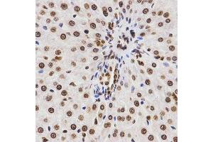 Immunohistochemistry of paraffin-embedded rat liver using DiMethyl-Histone H3-K9 antibody.