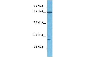 Host:  Rabbit  Target Name:  GSC  Sample Tissue:  Human 786-0 Whole Cell  Antibody Dilution:  1ug/ml