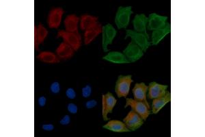 ABIN6257600 and ABIN6275123 staining Hela cells(45 min of heat-shock) by IF/ICC.