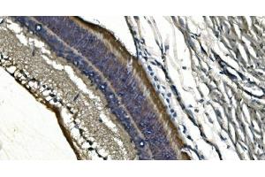 IHC analysis of PDE6 alpha/PDE6A using anti-PDE6 alpha/PDE6A antibody (ABIN7599710). (PDE6A anticorps  (AA 11-237))