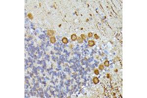Immunohistochemistry of paraffin-embedded mouse cerebellum using K/K/Elp3 antibody (ABIN6130883, ABIN6140142, ABIN6140143 and ABIN6225217) at dilution of 1:100 (40x lens). (ELP3/KAT9 anticorps  (AA 358-547))
