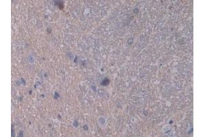 Detection of STAT2 in Rat Spinal cord Tissue using Polyclonal Antibody to Signal Transducer And Activator Of Transcription 2 (STAT2)