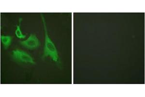 Immunofluorescence analysis of HeLa cells, treated with TNF-a (20nM, 15mins), using HSP90B (phospho-Ser254) antibody (ABIN5975888). (HSP90AB1 anticorps  (pSer254))
