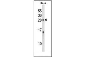Western blot analysis of PPP1R2 Antibody (PPP1R2 anticorps  (Middle Region))