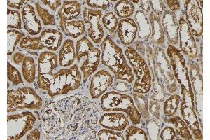ABIN6272923 at 1/100 staining Human kidney tissue by IHC-P.