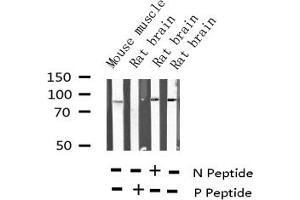Western blot analysis of Phospho-SP1 (Thr739) expression in various lysates (SP1 anticorps  (pThr739))