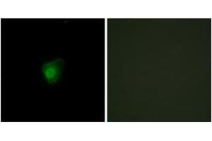 Immunofluorescence (IF) image for anti-Smg-7 Homolog, Nonsense Mediated mRNA Decay Factor (SMG7) (AA 521-570) antibody (ABIN2889700) (SMG7 anticorps  (AA 521-570))