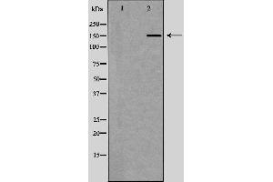 Western blot analysis of Hela whole cell lysates, using RAD50 Antibody. (RAD50 anticorps  (Internal Region))