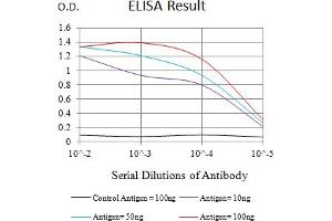 Black line: Control Antigen (100 ng),Purple line: Antigen (10 ng), Blue line: Antigen (50 ng), Red line:Antigen (100 ng)