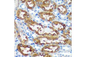 Immunohistochemistry of paraffin-embedded Mouse kidney using [KO Validated] CHCHD2 Rabbit pAb (ABIN7266448) at dilution of 1:100 (40x lens). (CHCHD2 anticorps  (AA 75-145))