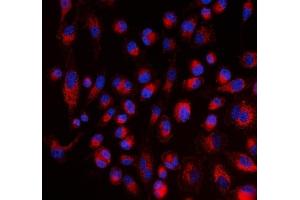 IF analysis of ALDH1A2 using anti-ALDH1A2 antibody (ABIN4886449). (ALDH1A2 anticorps  (AA 1-110))