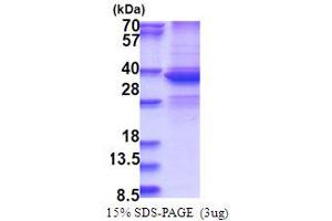 DEAD (Asp-Glu-Ala-Asp) Box Polypeptide 39A (DDX39) (AA 1-249) protein (His tag)