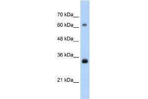 WB Suggested Anti-PCNA  Antibody Titration: 1.