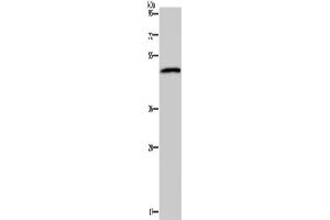 Western Blotting (WB) image for anti-Serotonin Receptor 2B (HTR2B) antibody (ABIN2827528) (Serotonin Receptor 2B anticorps)