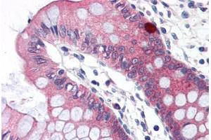 Human Colon (formalin-fixed, paraffin-embedded) stained with CLDN5 antibody ABIN364455 at 15 ug/ml followed by biotinylated goat anti-rabbit IgG secondary antibody ABIN481713, alkaline phosphatase-streptavidin and chromogen. (Claudin 5 anticorps  (C-Term))