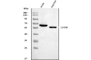 Western blot analysis of Cdc25b using anti-Cdc25b antibody (ABIN7599793).
