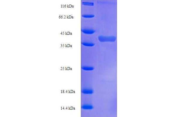 Klk1b22 Protein (AA 25-259) (His-SUMO Tag)
