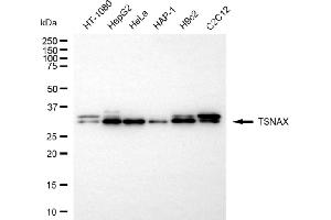 anti-Translin-Associated Factor X (TSNAX) antibody