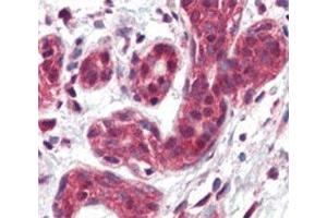 anti-Snail Family Zinc Finger 2 (SNAI2) (AA 98-129) antibody