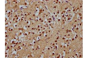 IHC image of ABIN7171755 diluted at 1:100 and staining in paraffin-embedded human brain tissue performed on a Leica BondTM system. (ODZ1/Teneurin 1 anticorps  (AA 1-241))