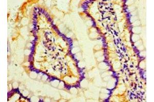 Immunohistochemistry of paraffin-embedded human small intestine tissue using ABIN7160116 at dilution of 1:100 (MOB1A anticorps  (AA 2-216))