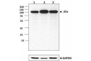 Western Blotting (WB) image for anti-Programmed Cell Death 6 Interacting Protein (PDCD6IP) antibody (ABIN2664051) (ALIX anticorps)