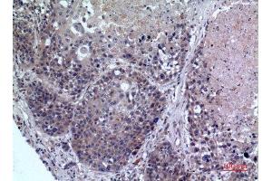 Immunohistochemistry (IHC) analysis of paraffin-embedded Human Lung, antibody was diluted at 1:100. (FMO3 anticorps  (Internal Region))