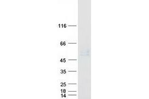 Validation with Western Blot
