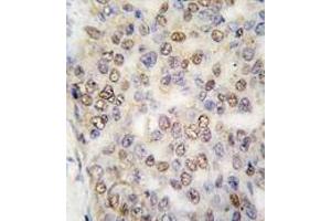Image no. 2 for anti-Actinin, alpha 4 (ACTN4) (N-Term) antibody (ABIN360099) (alpha Actinin 4 anticorps  (N-Term))