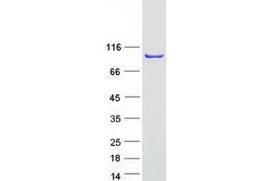Validation with Western Blot