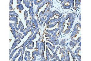 IHC analysis of ICAM1 using anti-ICAM1 antibody (ABIN7601066).