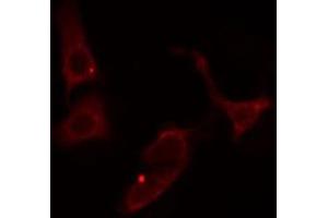 ABIN6274542 staining Hela cells by IF/ICC. (SHPK anticorps  (N-Term))