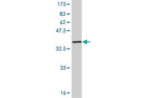 Western Blot detection against Immunogen (32. (SIX3 anticorps  (AA 273-332))