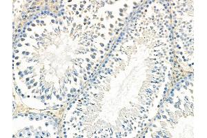 ABIN6265766 and ABIN6268647 at 1/100 staining Rat testis tissue by IHC-P. (TSC1 anticorps  (C-Term))