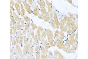 Immunohistochemistry of paraffin-embedded Rat heart using EIF2S1 Polyclonal Antibody at dilution of 1:100 (40x lens).