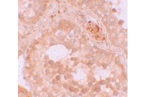 Immunohistochemistry (IHC) image for anti-WD Repeat Domain 92 (WDR92) (Middle Region) antibody (ABIN1031163) (WDR92 anticorps  (Middle Region))