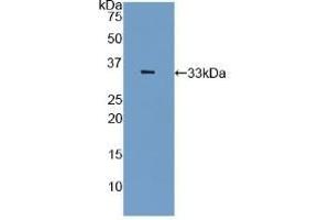 Detection of Recombinant PAI2, Rat using Polyclonal Antibody to Plasminogen Activator Inhibitor 2 (PAI2) (SERPINB2 anticorps  (AA 154-408))