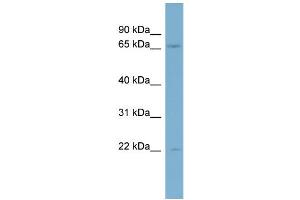WB Suggested Anti-KIF2B Antibody Titration:  0. (KIF2B anticorps  (Middle Region))