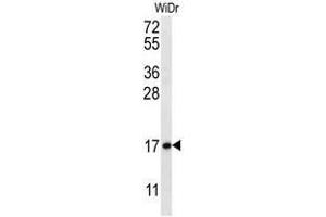 TBCA Antibody (N-term) western blot analysis in WiDr cell line lysates (35µg/lane). (TBCA anticorps  (N-Term))