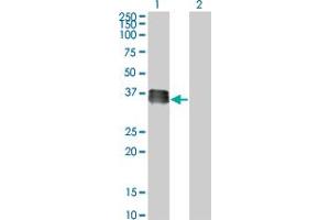 Western Blot analysis of SIX2 expression in transfected 293T cell line by SIX2 monoclonal antibody (M01), clone 3D7. (SIX2 anticorps  (AA 1-291))