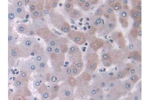 DAB staining on IHC-P; Samples: Human Liver Tissue (NELL2 anticorps  (AA 64-331))