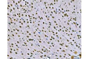 IHC analysis of SNRPN using anti-SNRPN antibody (ABIN3043934). (SNRPN anticorps  (N-Term))