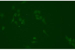 ABIN6276702 staining HEPG2 cells by ICC/IF.