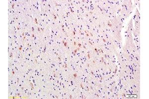 Formalin-fixed and paraffin-embedded rat brain labeled with Rabbit Anti-MTNR1A/MTR-1A/MEL-1A-R Polyclonal Antibody, Unconjugated  at 1:300 followed by conjugation to the secondary antibody