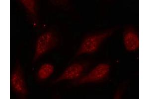 Immunofluorescence staining of methanol-fixed Hela cells using p53(Phospho-Ser315) Antibody.